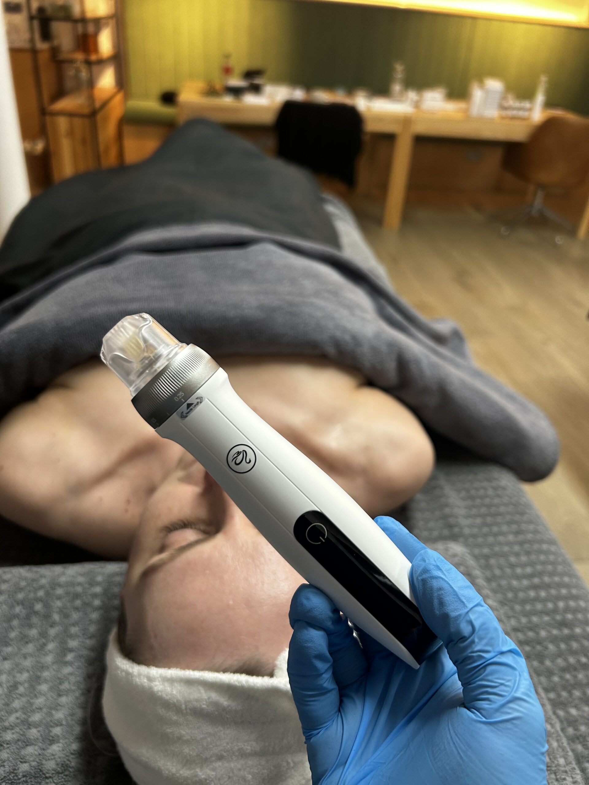 Why April is your last chance for a skin treatment before summer.